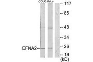 Image no. 1 for anti-Ephrin A2 (EFNA2) (AA 1-50) antibody (ABIN1533514)