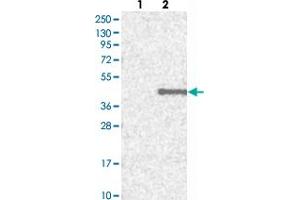 Image no. 2 for anti-Homeobox C11 (HOXC11) antibody (ABIN5580098)
