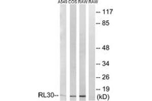 Image no. 1 for anti-Ribosomal Protein L30 (RPL30) (AA 66-115) antibody (ABIN1534565)