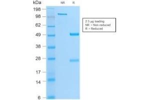 Image no. 1 for anti-Myogenic Differentiation 1 (MYOD1) antibody (ABIN6940161)