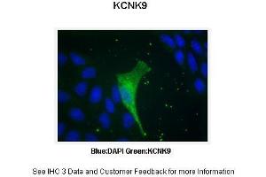 Image no. 7 for anti-Potassium Channel, Subfamily K, Member 9 (KCNK9) (N-Term) antibody (ABIN2776216)