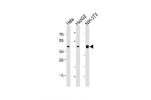 Image no. 8 for anti-Actin, beta (ACTB) antibody (ABIN658990)