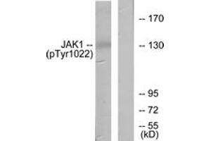 Image no. 2 for anti-Janus Kinase 1 (JAK1) (AA 988-1037), (pTyr1022) antibody (ABIN1531881)