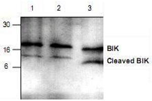 Image no. 1 for anti-BCL2-Interacting Killer (Apoptosis-Inducing) (BIK) (N-Term) antibody (ABIN223382)