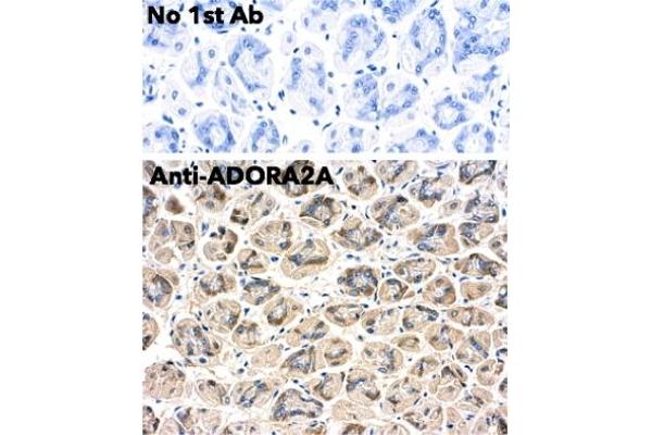 Adenosine A2a Receptor anticorps  (C-Term)
