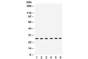 Image no. 2 for anti-Eukaryotic Translation Initiation Factor 6 (EIF6) (AA 66-210) antibody (ABIN4950900)