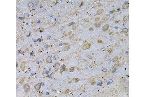 Immunohistochemistry of paraffin-embedded Rat brain using GAD2 Polyclonal Antibody at dilution of 1:100 (40x lens).