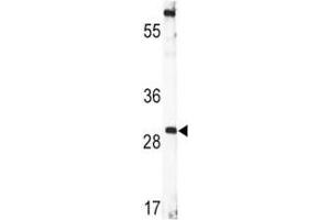 BDNF antibody  (AA 206-236)