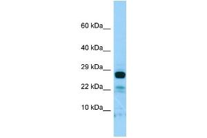 Image no. 1 for anti-Interleukin 22 Receptor, alpha 2 (IL22RA2) (C-Term) antibody (ABIN2790188)