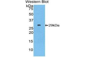 Image no. 1 for anti-SH2B Adaptor Protein 3 (SH2B3) (AA 335-561) antibody (ABIN1859674)