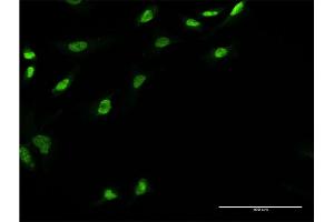 Immunofluorescence of monoclonal antibody to UBE2E3 on HeLa cell.