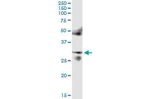 Image no. 1 for anti-FOS-Like Antigen 2 (FOSL2) (AA 1-326) antibody (ABIN515798)