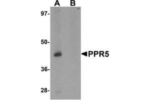 Image no. 1 for anti-Proline Rich 5 (Renal) (PRR5) (C-Term) antibody (ABIN783442)