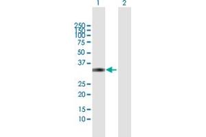 Image no. 1 for anti-Dickkopf Homolog 4 (Xenopus Laevis) (DKK4) (AA 1-224) antibody (ABIN949206)