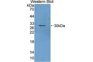 Detection of Recombinant PTTG1, Mouse using Polyclonal Antibody to Pituitary Tumor Transforming 1 (PTTG1)