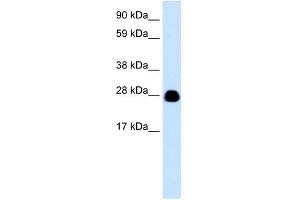 Image no. 2 for anti-14-3-3 eta (YWHAH) (N-Term) antibody (ABIN926886)