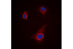 Image no. 1 for anti-Autophagy related 4C Cysteine Peptidase (ATG4C) (N-Term) antibody (ABIN2707346)