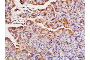 Image no. 3 for anti-Angiotensin I Converting Enzyme (Peptidyl-Dipeptidase A) 1 (ACE) (AA 801-900) antibody (ABIN668631)