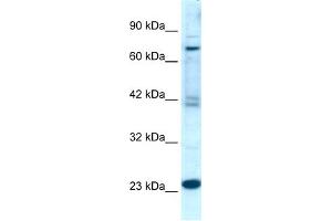 anti-Regulator of G-Protein Signaling 10 (RGS10) (Middle Region) antibody