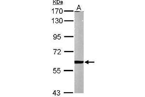 Image no. 3 for anti-Matrix Metalloproteinase 2 (MMP2) (Center) antibody (ABIN2855854)