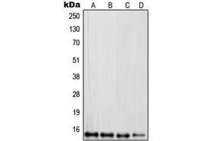 Image no. 2 for anti-Ribosomal Protein L30 (RPL30) (C-Term) antibody (ABIN2705203)