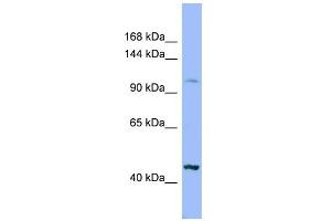 Image no. 1 for anti-Xylosyltransferase II (XYLT2) (Middle Region) antibody (ABIN2783857)