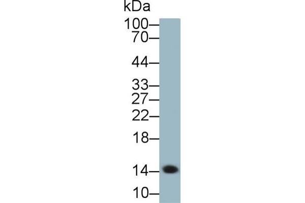 SAA anticorps  (AA 19-122)