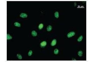 Image no. 2 for anti-E1A Binding Protein P300 (EP300) antibody (ABIN930935)