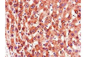 Immunohistochemistry of paraffin-embedded human liver tissue using ABIN7164866 at dilution of 1:100