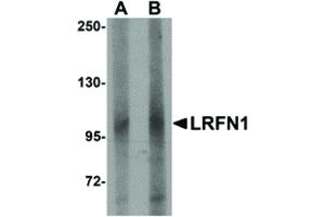 Image no. 1 for anti-Leucine Rich Repeat and Fibronectin Type III Domain Containing 1 (LRFN1) (C-Term) antibody (ABIN6657064)