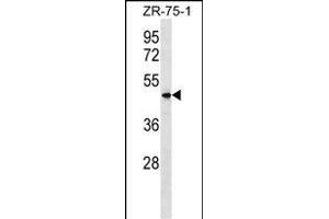 VN1R5 Antibody (Center) (ABIN1538092 and ABIN2849758) western blot analysis in ZR-75-1 cell line lysates (35 μg/lane).