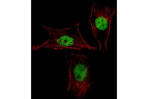 Fluorescent image of NIH-3T3 cell stained with MEOX2 Antibody (Center) (ABIN1537918 and ABIN2849884).