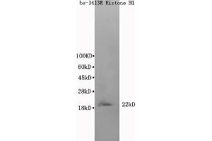 Image no. 1 for anti-Histone Cluster 1, H1t (HIST1H1T) (AA 51-207) antibody (ABIN686197)