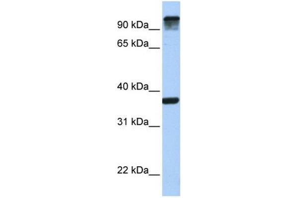 EPS15 antibody  (C-Term)