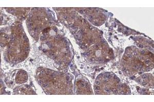 Image no. 2 for anti-Sprouty RTK Signaling Antagonist 4 (SPRY4) (Internal Region) antibody (ABIN6264444)