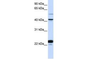 Image no. 1 for anti-EVX1 (EVX1) (AA 36-85) antibody (ABIN6744223)