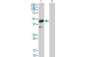 Western Blot analysis of CALR3 expression in transfected 293T cell line by CALR3 monoclonal antibody (M01), clone 4E3.
