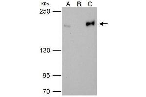 Image no. 1 for anti-Topoisomerase (DNA) II beta 180kDa (TOP2B) (C-Term) antibody (ABIN2855447)
