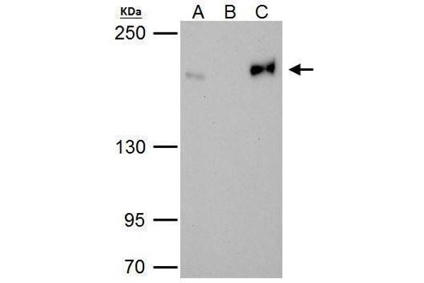 anti-Topoisomerase (DNA) II beta 180kDa (TOP2B) (C-Term) antibody