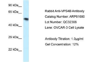 Image no. 1 for anti-Vacuolar Protein Sorting 4 Homolog B (vps4b) (N-Term) antibody (ABIN2774320)