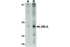 Image no. 1 for anti-Nuclear Receptor Subfamily 1, Group H, Member 3 (NR1H3) (N-Term) antibody (ABIN6657036)