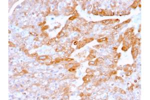 Image no. 6 for anti-Tumor Necrosis Factor Receptor Superfamily, Member 9 (TNFRSF9) (AA 19-188) antibody (ABIN6939788)