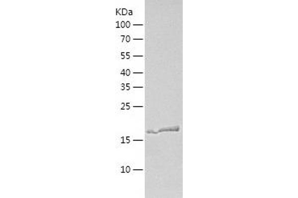 Sorting Nexin 3 Protein (SNX3) (AA 1-162) (His tag)