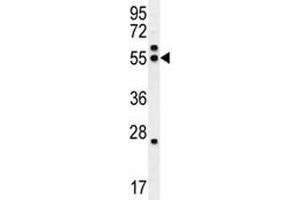 Image no. 2 for anti-Tubulin, beta 8 (TUBB8) (AA 320-347) antibody (ABIN3029773)