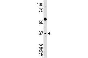 Image no. 1 for anti-DKK3 (N-Term) antibody (ABIN357071)