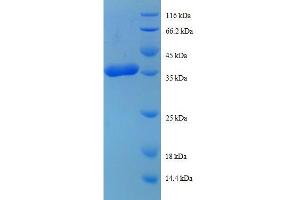 Image no. 1 for Ribosomal Protein L38 (RPL38) (AA 2-70) protein (GST tag) (ABIN1607978)