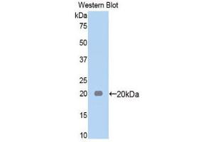Image no. 1 for anti-alpha-2-Macroglobulin (A2M) (AA 574-734) antibody (ABIN1857847)
