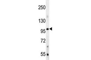 Image no. 3 for anti-Bone Morphogenetic Protein 1 (BMP1) (AA 957-986) antibody (ABIN3030175)