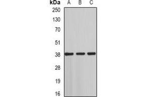 anti-ST3 beta-Galactoside alpha-2,3-Sialyltransferase 4 (ST3GAL4) antibody