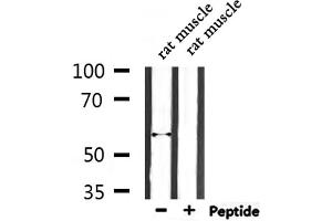 Image no. 1 for anti-Endonuclease Domain Containing 1 (ENDOD1) (Internal Region) antibody (ABIN6261532)